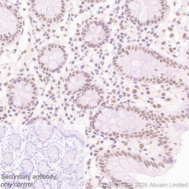 Immunohistochemistry (Formalin/PFA-fixed paraffin-embedded sections) - Anti-Zinc finger MIZ domain-containing protein 1 antibody [EPR29807-525] (AB326070)