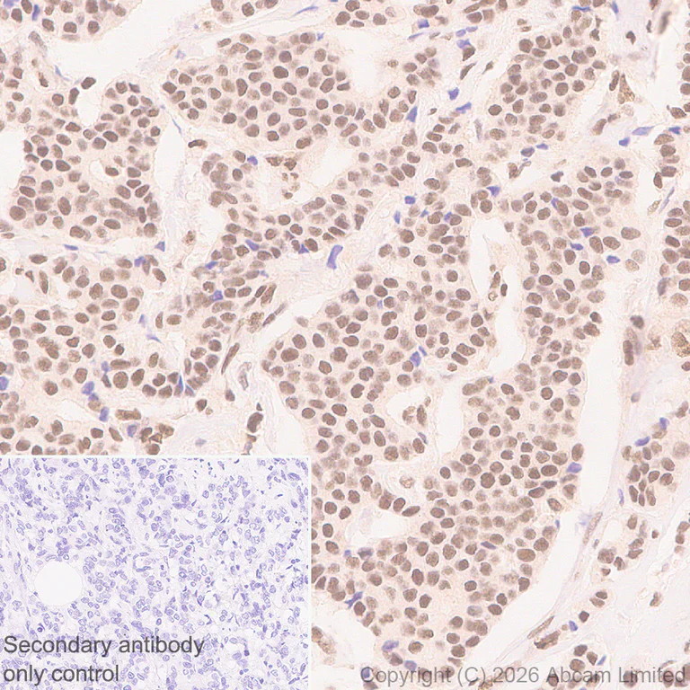 Immunohistochemistry (Formalin/PFA-fixed paraffin-embedded sections) - Anti-Zinc finger MIZ domain-containing protein 1 antibody [EPR29807-525] (AB326070)