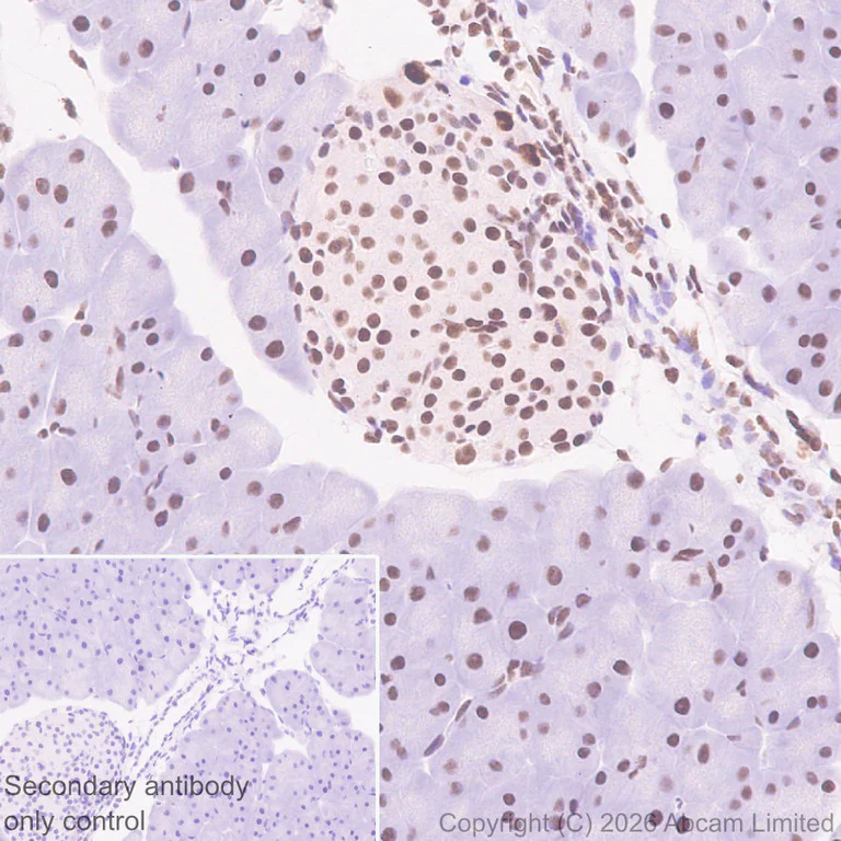 Immunohistochemistry (Formalin/PFA-fixed paraffin-embedded sections) - Anti-Zinc finger MIZ domain-containing protein 1 antibody [EPR29807-525] (AB326070)