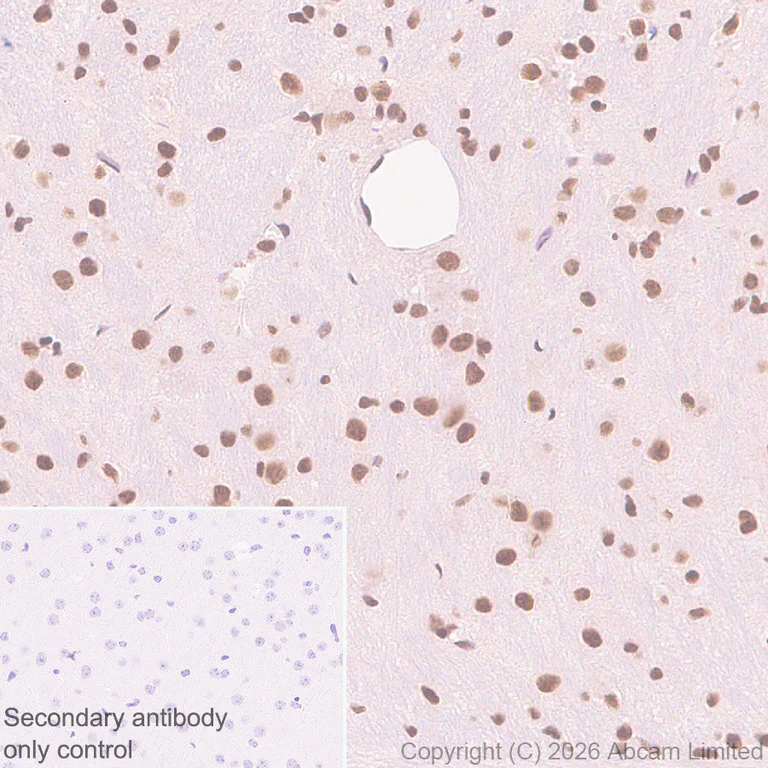 Immunohistochemistry (Formalin/PFA-fixed paraffin-embedded sections) - Anti-Zinc finger MIZ domain-containing protein 1 antibody [EPR29807-525] (AB326070)