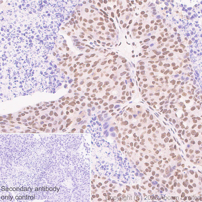 Immunohistochemistry (Formalin/PFA-fixed paraffin-embedded sections) - Anti-Zinc finger MIZ domain-containing protein 1 antibody [EPR29807-525] (AB326070)