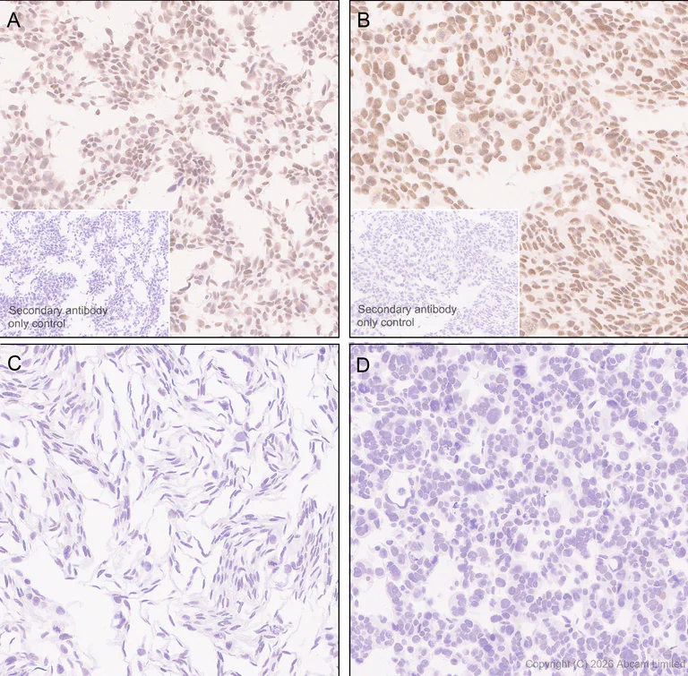 Immunohistochemistry (Formalin/PFA-fixed paraffin-embedded sections) - Anti-Zinc finger MIZ domain-containing protein 1 antibody [EPR29807-525] (AB326070)