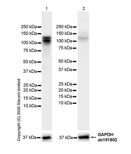 Western blot - Anti-Zinc finger MIZ domain-containing protein 1 antibody [EPR29807-525] (AB326070)