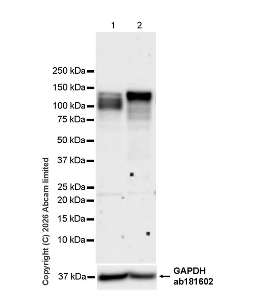 Western blot - Anti-Zinc finger MIZ domain-containing protein 1 antibody [EPR29807-525] (AB326070)