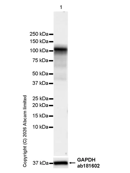 Western blot - Anti-Zinc finger MIZ domain-containing protein 1 antibody [EPR29807-525] (AB326070)