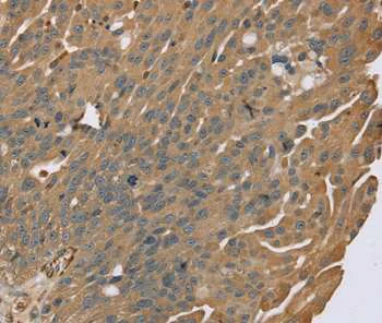 Immunohistochemistry (Formalin/PFA-fixed paraffin-embedded sections) - Anti-Zinc finger MIZ domain-containing protein 1 antibody - N-terminal (AB200376)