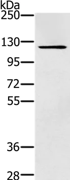 Western blot - Anti-Zinc finger MIZ domain-containing protein 1 antibody - N-terminal (AB200376)
