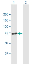 Western blot - Anti-Zinc finger protein 668 antibody (AB169587)