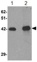 Western blot - Anti-ZIP-12 antibody (AB106570)