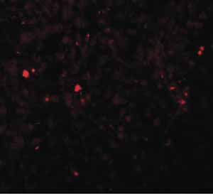 Immunocytochemistry/ Immunofluorescence - Anti-ZIP-13 antibody (AB106586), expandable thumbnail