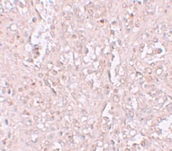 Immunohistochemistry (Formalin/PFA-fixed paraffin-embedded sections) - Anti-ZIP-13 antibody (AB106586), expandable thumbnail