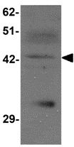 Western blot - Anti-ZIP-13 antibody (AB106586), expandable thumbnail