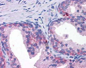 Immunohistochemistry (Formalin/PFA-fixed paraffin-embedded sections) - Anti-ZIP-3 antibody (AB117568)