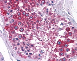 Immunohistochemistry (Formalin/PFA-fixed paraffin-embedded sections) - Anti-ZIP-3 antibody (AB117568)