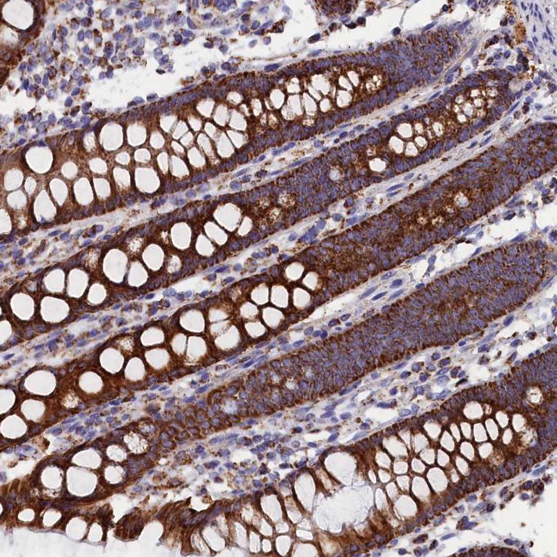 Immunohistochemistry (Formalin/PFA-fixed paraffin-embedded sections) - Anti-ZIP-3 antibody (AB254868)