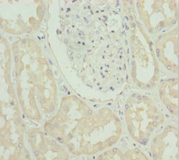 Immunohistochemistry (Formalin/PFA-fixed paraffin-embedded sections) - Anti-ZIP-4 antibody (AB230099), expandable thumbnail