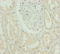 Immunohistochemistry (Formalin/PFA-fixed paraffin-embedded sections) - Anti-ZIP-4 antibody (AB230099)