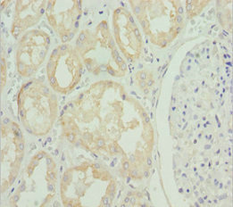 Immunohistochemistry (Formalin/PFA-fixed paraffin-embedded sections) - Anti-ZIP-4 antibody (AB230121)