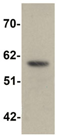 Western blot - Anti-ZIP-5 antibody (AB105194)