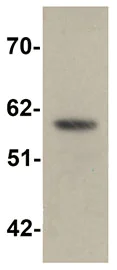 Western blot - Anti-ZIP-5 antibody (AB105194)