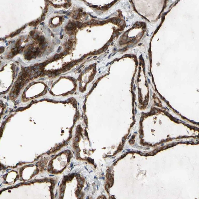 Immunohistochemistry (Formalin/PFA-fixed paraffin-embedded sections) - Anti-ZIP-9 antibody (AB272557)