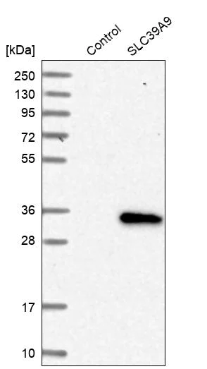 Western blot - Anti-ZIP-9 antibody (AB272557)