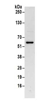 Immunoprecipitation - Anti-ZIP Kinase antibody - C-terminal (AB186066), expandable thumbnail