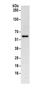 Immunoprecipitation - Anti-ZIP Kinase antibody - C-terminal (AB186066)