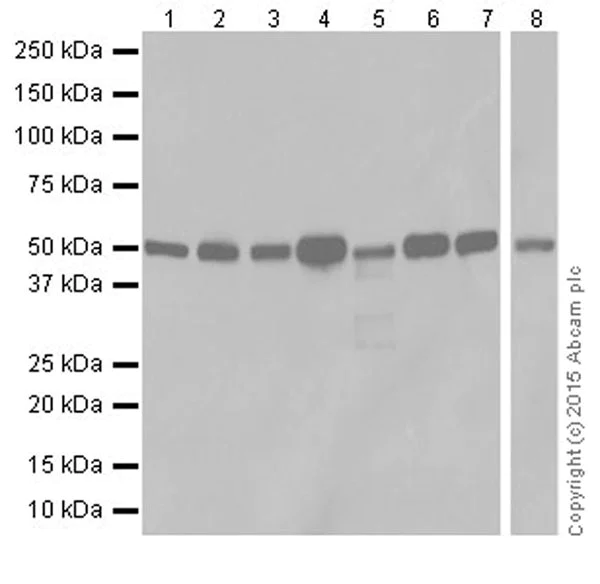 Western blot - Anti-ZIP Kinase antibody [EPR18809-86] (AB210528)