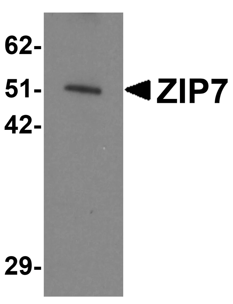 AB様 確認用 Anti-SNAP25 antibody. Rabbit polyclonal (ab5666) | Abcam