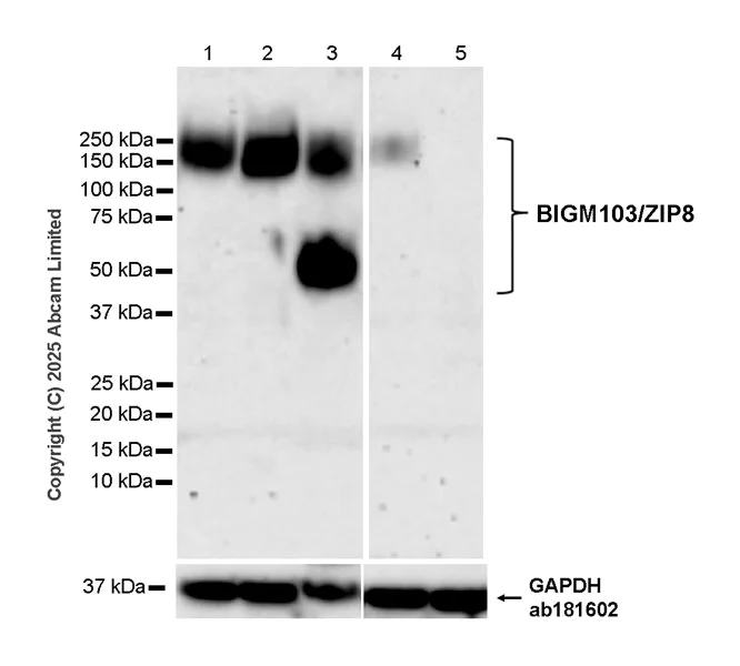 Western blot - Anti-ZIP8/SLC39A8 antibody [EPR29194-220] (AB325498)