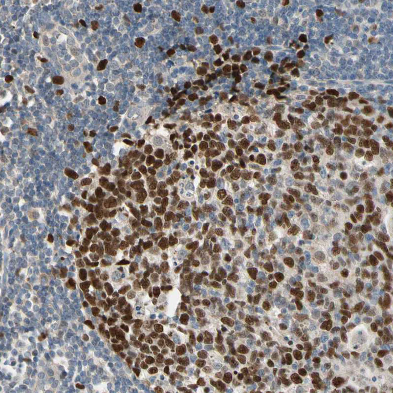 Immunohistochemistry (Formalin/PFA-fixed paraffin-embedded sections) - Anti-ZKSCAN3 antibody (AB187866)
