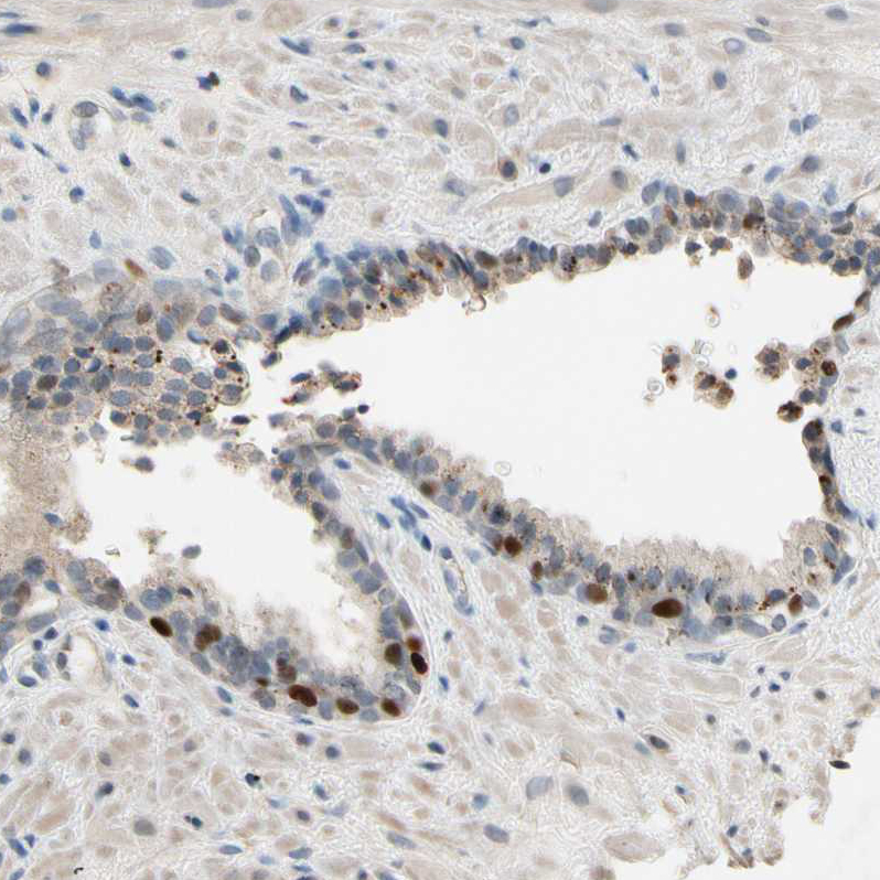 Immunohistochemistry (Formalin/PFA-fixed paraffin-embedded sections) - Anti-ZKSCAN3 antibody (AB187866)