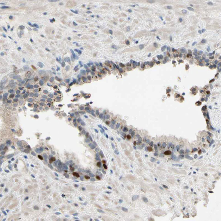 Immunohistochemistry (Formalin/PFA-fixed paraffin-embedded sections) - Anti-ZKSCAN3 antibody (AB187866)