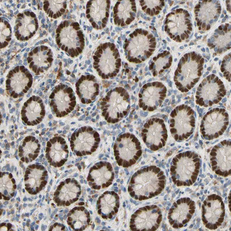 Immunohistochemistry (Formalin/PFA-fixed paraffin-embedded sections) - Anti-ZKSCAN3 antibody (AB187866)
