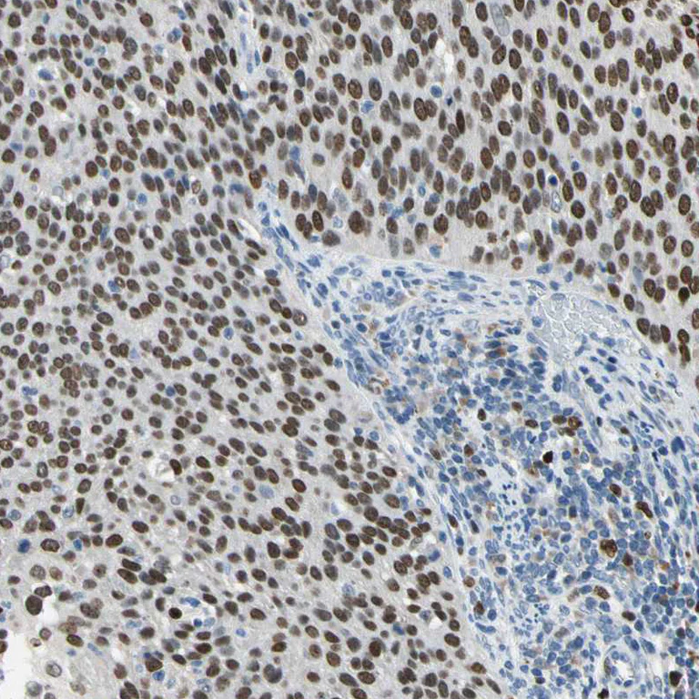 Immunohistochemistry (Formalin/PFA-fixed paraffin-embedded sections) - Anti-ZKSCAN3 antibody (AB187866)