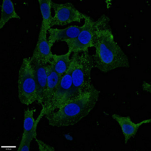 Immunocytochemistry/ Immunofluorescence - Anti-ZKSCAN3 antibody (AB223477)