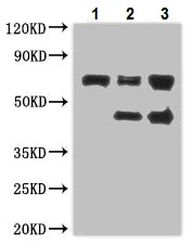 Western blot - Anti-ZKSCAN3 antibody (AB223477)