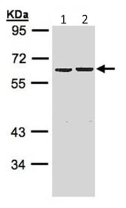Western blot - Anti-ZKSCAN3 antibody (AB96731), expandable thumbnail