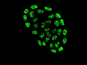 Immunocytochemistry/ Immunofluorescence - Anti-Zmat2 antibody [EPR11136] (AB169541), expandable thumbnail