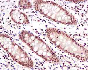 Immunohistochemistry (Formalin/PFA-fixed paraffin-embedded sections) - Anti-Zmat2 antibody [EPR11136] (AB169541), expandable thumbnail