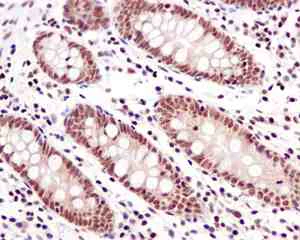 Immunohistochemistry (Formalin/PFA-fixed paraffin-embedded sections) - Anti-Zmat2 antibody [EPR11136] (AB169541)