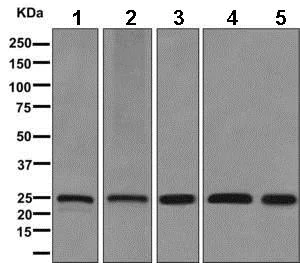 Western blot - Anti-Zmat2 antibody [EPR11136] (AB169541)