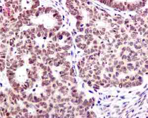 Immunohistochemistry (Formalin/PFA-fixed paraffin-embedded sections) - Anti-Zmat2 antibody [EPR11136] - BSA and Azide free (AB249493)