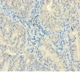 Immunohistochemistry (Formalin/PFA-fixed paraffin-embedded sections) - Anti-ZMAT5 antibody (AB235355)