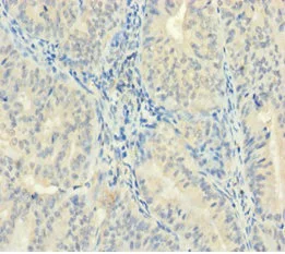 Immunohistochemistry (Formalin/PFA-fixed paraffin-embedded sections) - Anti-ZMAT5 antibody (AB235355)