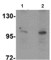 Western blot - Anti-ZMIZ2 antibody (AB113277)