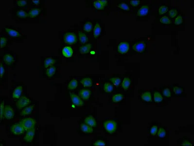 Immunocytochemistry/ Immunofluorescence - Anti-ZMPSTE24 antibody (AB234832)