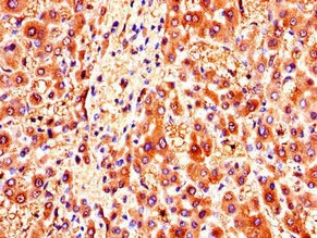 Immunohistochemistry (Formalin/PFA-fixed paraffin-embedded sections) - Anti-ZMPSTE24 antibody (AB234832)