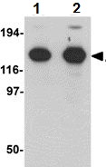 Western blot - Anti-ZMYM2/RAMP antibody (AB106624)
